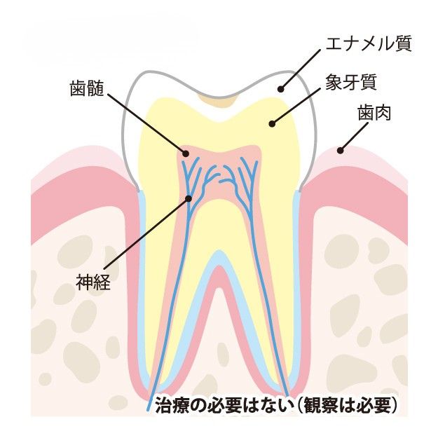 C0（初期段階）